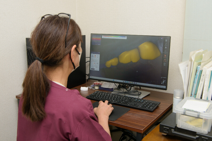 製作の流れ｜CAD／CAM｜茨城県桜川市「土井歯科クリニック」