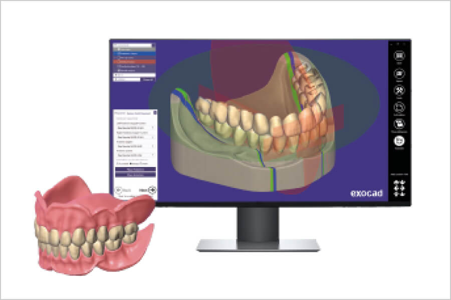 製作の流れ｜CAD／CAM｜茨城県桜川市「土井歯科クリニック」